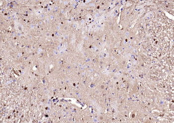 S100B Mouse Monoclonal Antibody