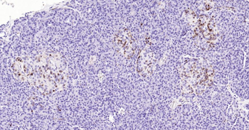 S100B Mouse Monoclonal Antibody