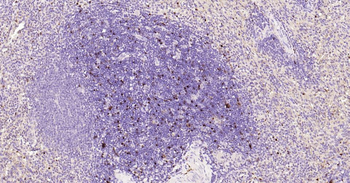 S100B Mouse Monoclonal Antibody