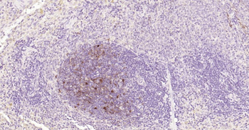 S100B Mouse Monoclonal Antibody