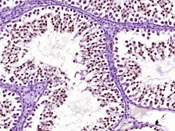 HDAC9 Rabbit Polyclonal Antibody