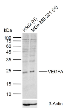VEGFA Rabbit Polyclonal Antibody