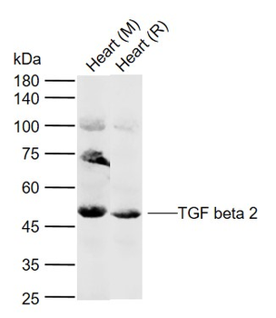 TGF beta 2 Rabbit Polyclonal Antibody