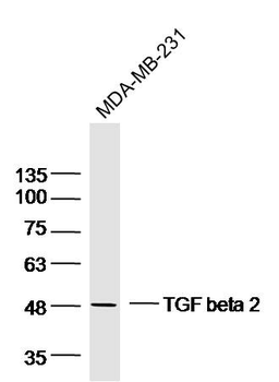TGF beta 2 Rabbit Polyclonal Antibody