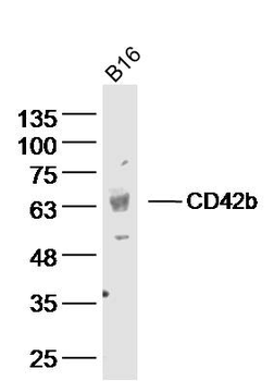 GP1BA Rabbit Polyclonal Antibody