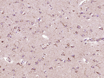 SMAD1 Rabbit Polyclonal Antibody