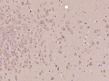 SMAD1 Rabbit Polyclonal Antibody