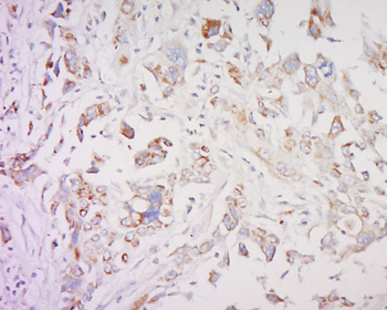 SMAD1 Rabbit Polyclonal Antibody