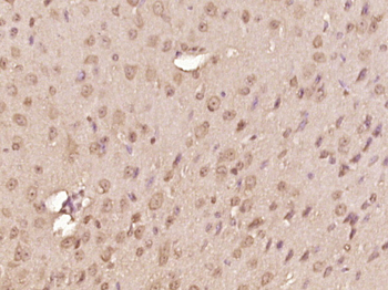 RNF39 Rabbit Polyclonal Antibody