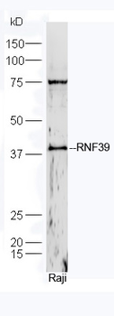 RNF39 Rabbit Polyclonal Antibody