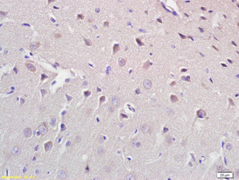 CROT Rabbit Polyclonal Antibody