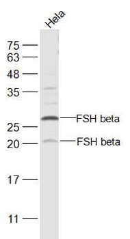 FSH beta Rabbit Polyclonal Antibody