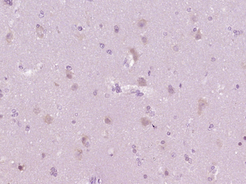 Phospho-Tau Protein (Thr181) Rabbit Polyclonal Antibody