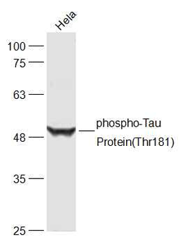 Phospho-Tau Protein (Thr181) Rabbit Polyclonal Antibody