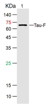 Phospho-Tau Protein (Thr181) Rabbit Polyclonal Antibody