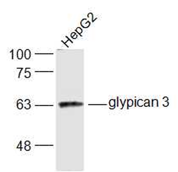 Glypican 3 Rabbit Polyclonal Antibody