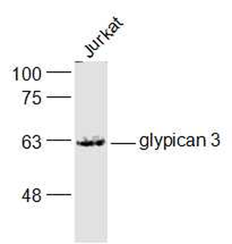 Glypican 3 Rabbit Polyclonal Antibody