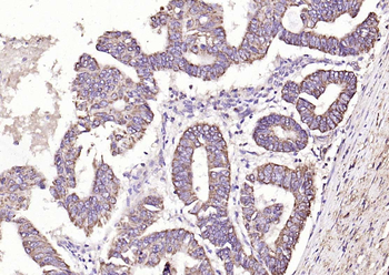 MCL1 Rabbit Polyclonal Antibody