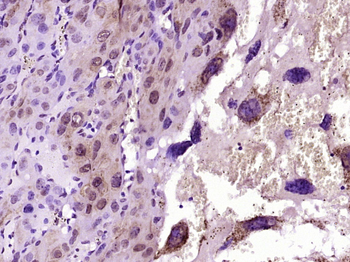 MCL1 Rabbit Polyclonal Antibody