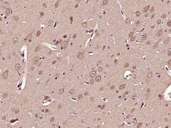 GCLC Rabbit Polyclonal Antibody