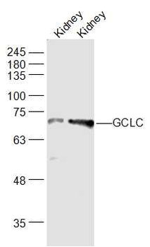 GCLC Rabbit Polyclonal Antibody