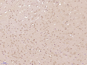 PER2 Rabbit Polyclonal Antibody