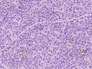 PER2 Rabbit Polyclonal Antibody