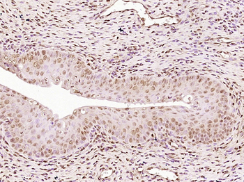 Progesterone Receptor Rabbit Polyclonal Antibody