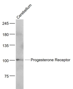 Progesterone Receptor Rabbit Polyclonal Antibody