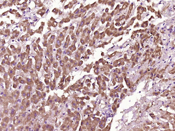 Myoglobin Rabbit Polyclonal Antibody