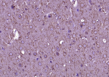 Beta I Tubulin Mouse Monoclonal Antibody (Loading Control)