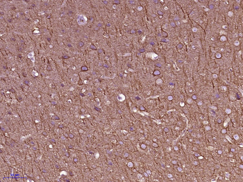 Beta I Tubulin Mouse Monoclonal Antibody (Loading Control)