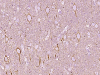 Beta I Tubulin Mouse Monoclonal Antibody (Loading Control)