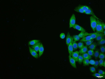 Cytokeratin 19 Mouse Monoclonal Antibody