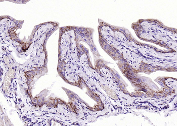 Cytokeratin 19 Mouse Monoclonal Antibody