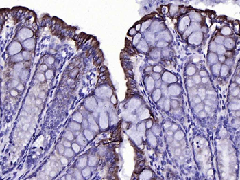 Cytokeratin 19 Mouse Monoclonal Antibody