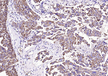Cytokeratin 19 Mouse Monoclonal Antibody