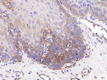Cytokeratin 19 Mouse Monoclonal Antibody