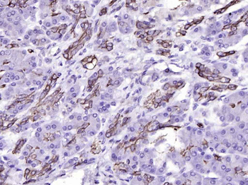 Cytokeratin 19 Mouse Monoclonal Antibody