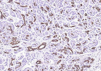 Cytokeratin 19 Mouse Monoclonal Antibody