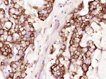 Cytokeratin 19 Mouse Monoclonal Antibody
