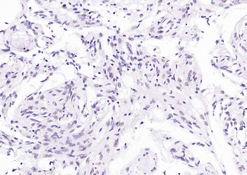 HP1 alpha Mouse Monoclonal Antibody