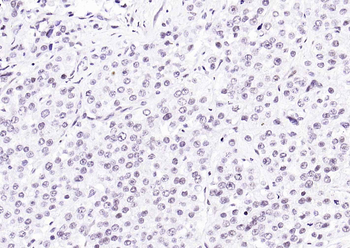 HP1 alpha Mouse Monoclonal Antibody