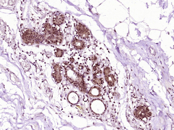 HSP70 Mouse Monoclonal Antibody