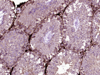 HSP70 Mouse Monoclonal Antibody