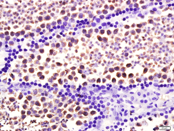 HSP70 Mouse Monoclonal Antibody