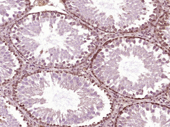 HSP70 Mouse Monoclonal Antibody