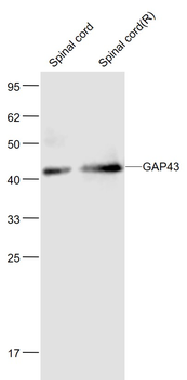 GAP43 Mouse Monoclonal Antibody