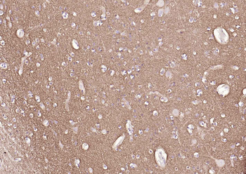 GAP43 Mouse Monoclonal Antibody