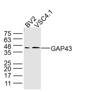 GAP43 Mouse Monoclonal Antibody